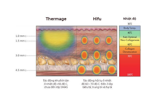 Giải đáp về công nghệ Hifu trong trẻ hóa làn da và nâng cơ Hifu giá bao nhiêu 