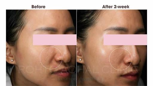 Các spa ở quận 7 trẻ hoá da mặt bằng công nghệ cao uy tín nhất hiện nay