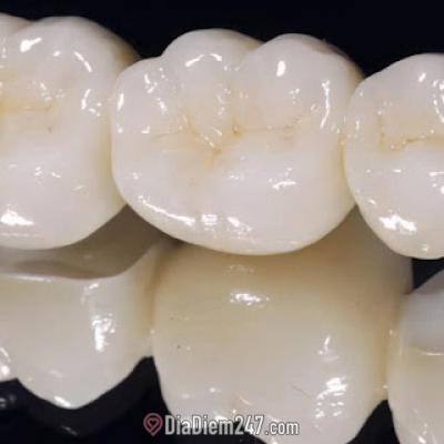 Báo giá bọc răng sứ 2022 - Bọc răng sứ Nha khoa DAISY